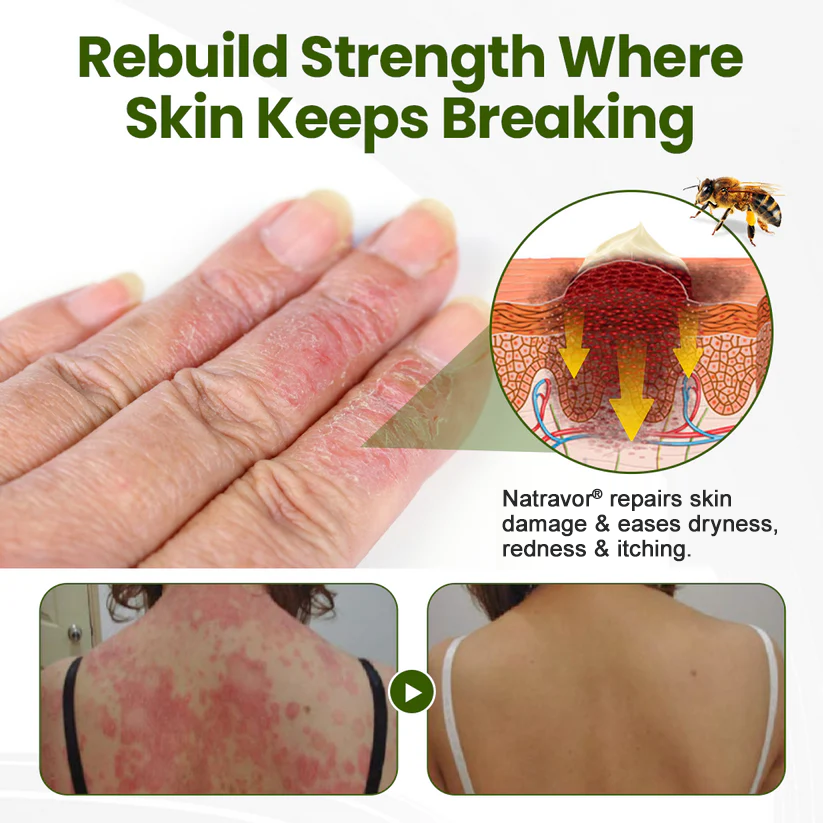 Natravor® BeePeptide RootSoft DualRelief Cream