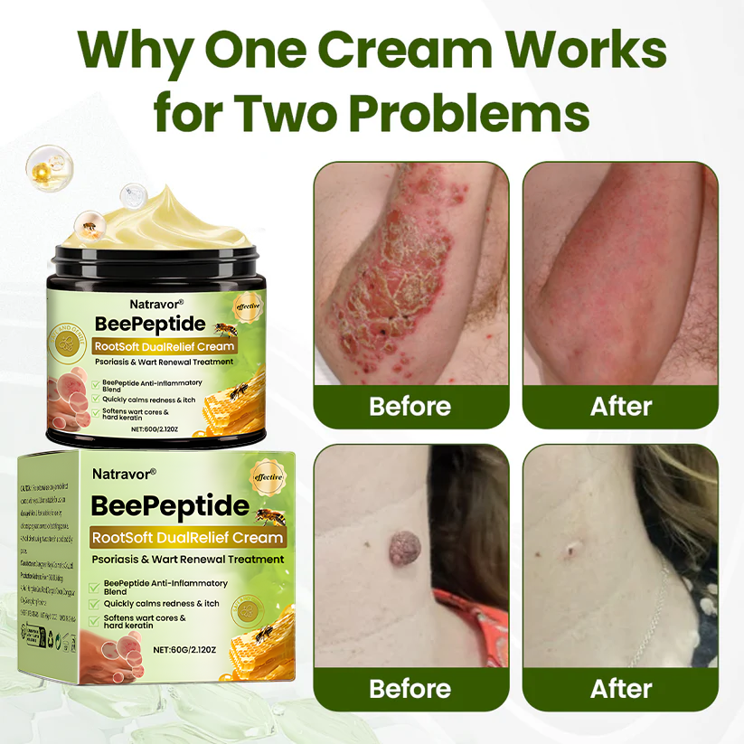 Natravor® BeePeptide RootSoft DualRelief Cream