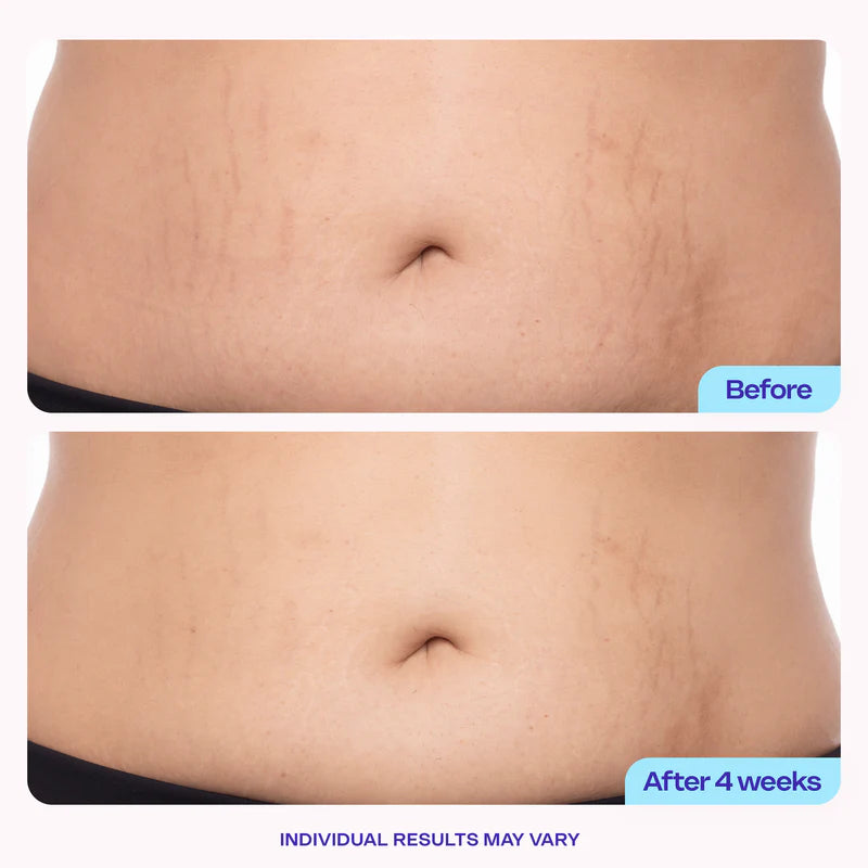 NATRAVOR® Tighten & Smooth Belly Cream