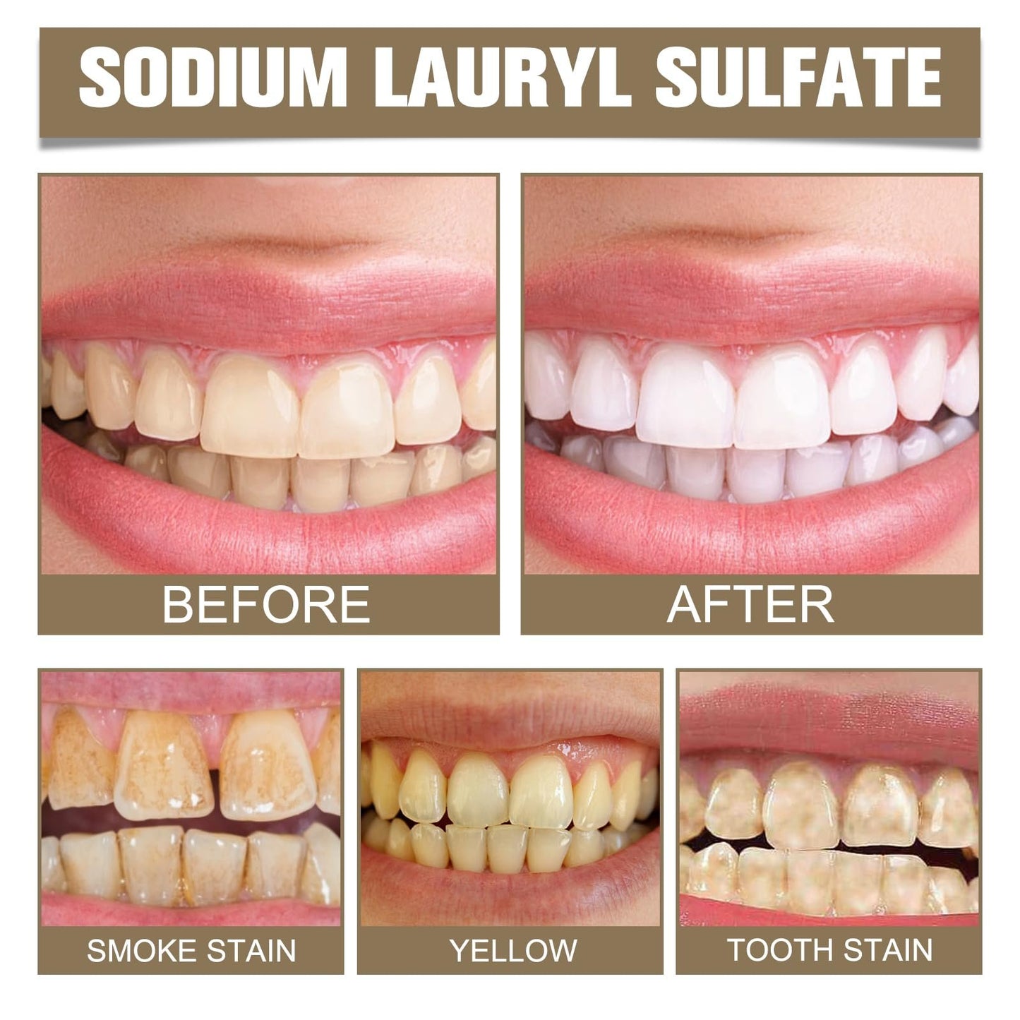 LAST DAY SALE 49% OFF🔥Nature Oral Care Toothpaste, Fresh Breath, Prevent Tooth Loss, Natural Ingredients, Gentle Care