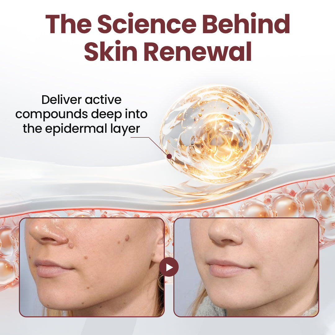 NATRAVOR®KeraErase Dual-Action Renewal Cream