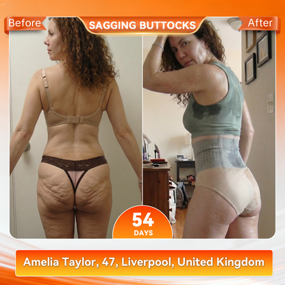 🎖️ Official Brand Store |🐉✨ 2026 Moringa & Berberine 4-in-1 Micro-Particle Sculpting & Fat-Burn Shorts