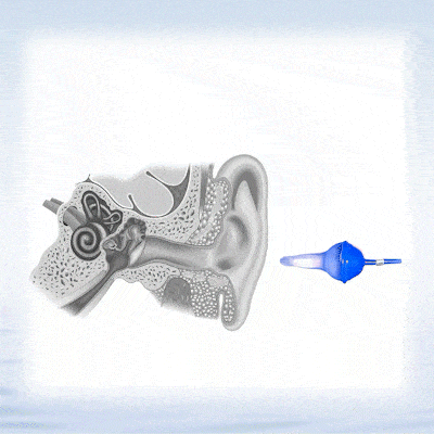💥2025 NEW DESIGN👂The World's First Fluid Inflatable Earplug