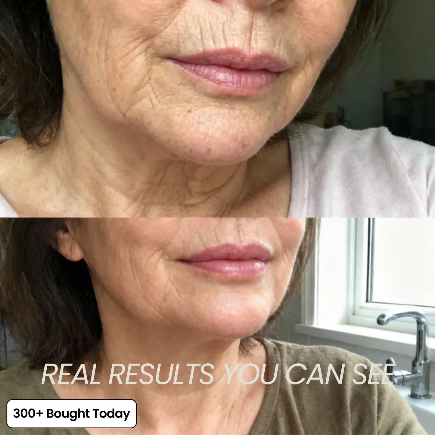 ✨LAST DAY 60% OFF Elmstr Korean Pink Collagen Volume Multi Balm