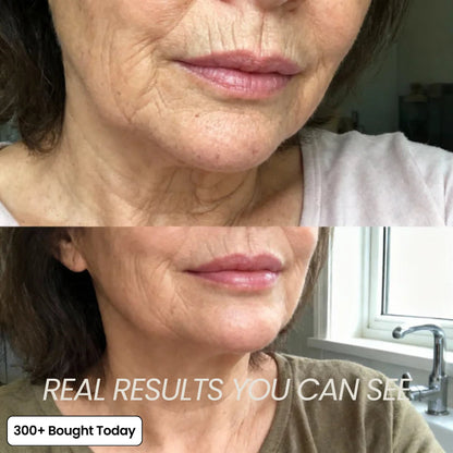 ✨LAST DAY 60% OFF Elmstr Korean Pink Collagen Volume Multi Balm
