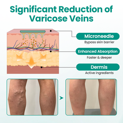 NATRAVOR® LegRenew Varicose Veins Patch