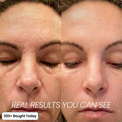 ✨LAST DAY 60% OFF Elmstr Korean Pink Collagen Volume Multi Balm