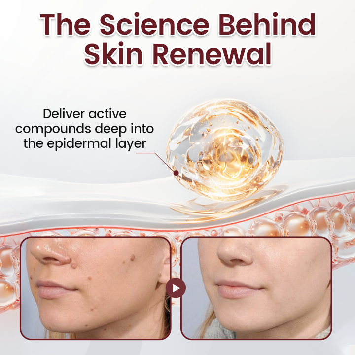 Natravor® BumpAway Gentle Renewal Cream