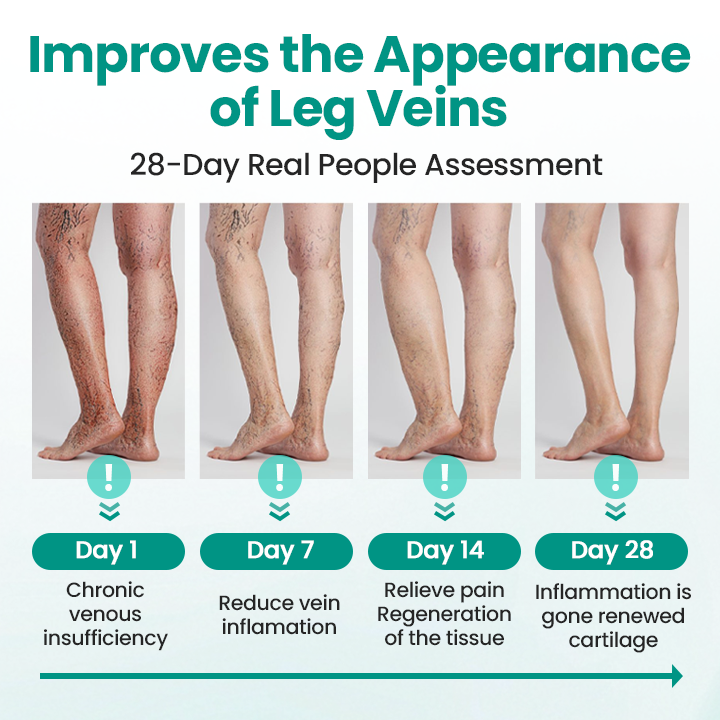 NATRAVOR® LegRenew Varicose Veins Patch