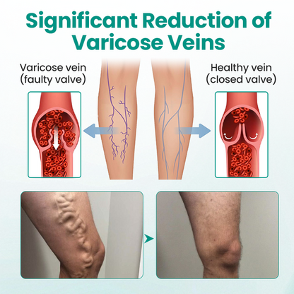 NATRAVOR® LegRenew Varicose Veins Patch