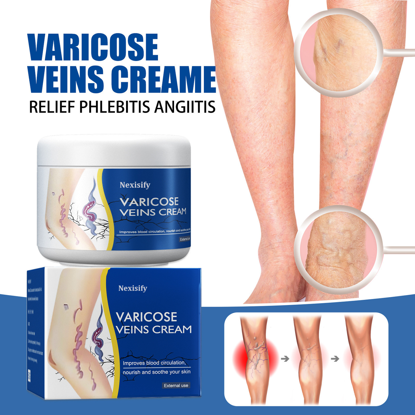 Leg Relief Varicose Veins Cream 50g – Soothing Lotion for Pain, Swelling & Circulation