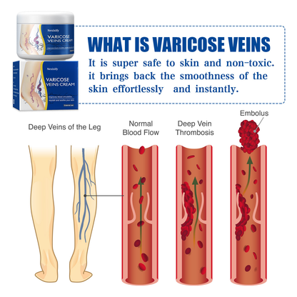 Leg Relief Varicose Veins Cream 50g – Soothing Lotion for Pain, Swelling & Circulation